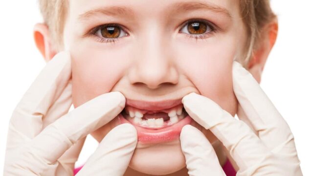 توقيت ظهور الاسنان للأطفال الدائمة والمؤقتة