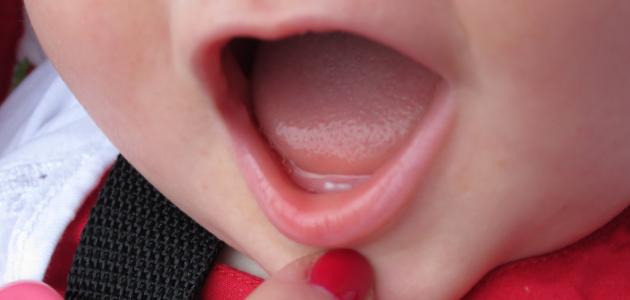 مراحل تطور الطفل ظهور الأسنان