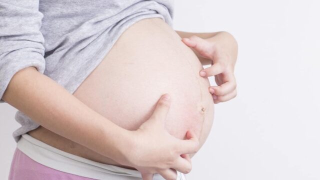أهم اسباب الحكّة والحساسية لدى الحامل وعلاجها مجرب