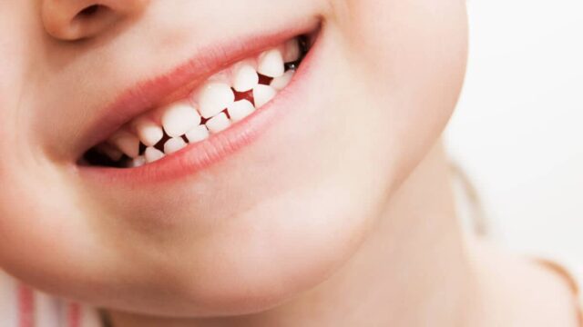 الأسنان اللبنية أو أسنان الحليب بحسب ترتيب ظهورها صور