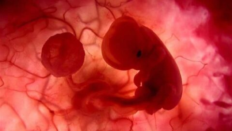 شكل كيس الحمل بعد الإجهاض