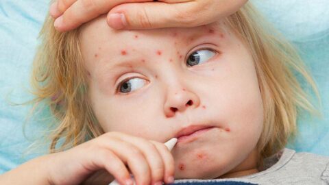 حساسية الجلد عند الأطفال حديثي الولادة الأعراض والأسباب والعلاج