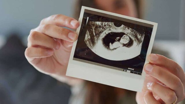 متى يبان الجنين في كيس الحمل ( أعراض كيس الحمل الفارغ وأسبابه )