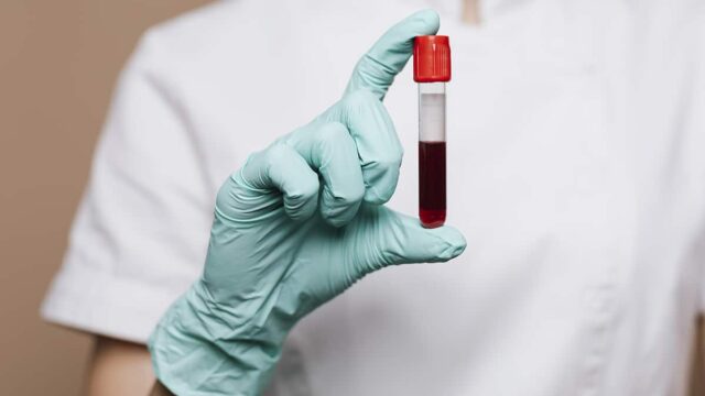 هل يجب الصيام قبل تحليل الدم للحمل