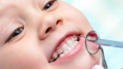 أسباب تكلس الأسنان عند الأطفال