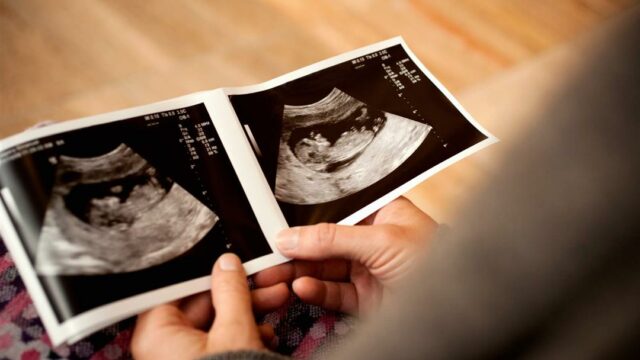علامات الحمل بولد بالسونار اكتشاف نوع الجنين بالتفصيل
