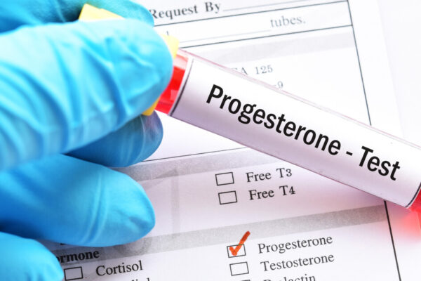 شرح تغير النسبة الطبيعية في هرمون البروجسترون حسب طول الدورة الشهرية