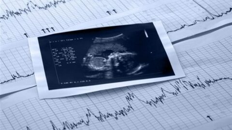 شرح تخطيط ctg لمراقبة قلب الجنين وقوة المخاض ودوره في تشخيص صحة الجنين ونسبة خطورة الحمل
