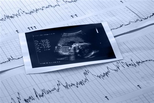 شرح تخطيط ctg لمراقبة قلب الجنين وقوة المخاض ودوره في تشخيص صحة الجنين ونسبة خطورة الحمل